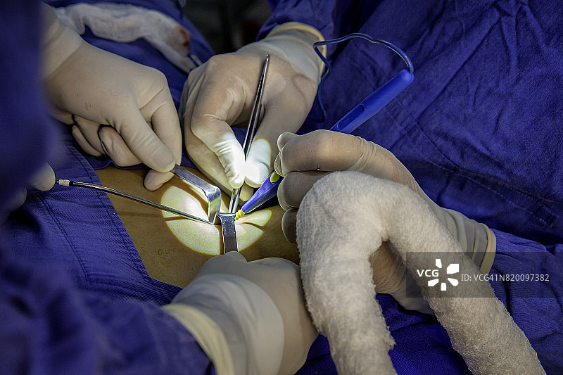 女性患者的鼻中隔偏曲和鼻整形手术图片素材