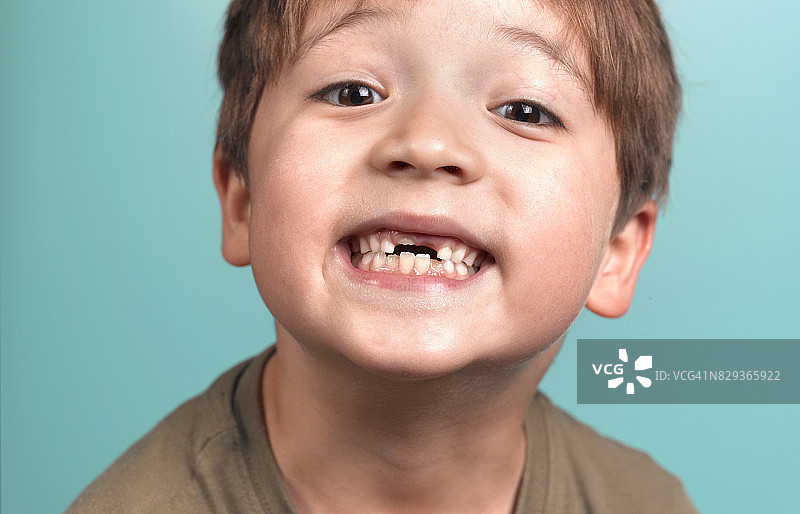 自豪地展示掉牙齿的男孩图片素材