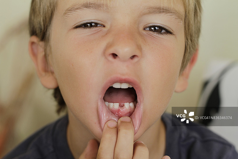 无牙的微笑图片素材