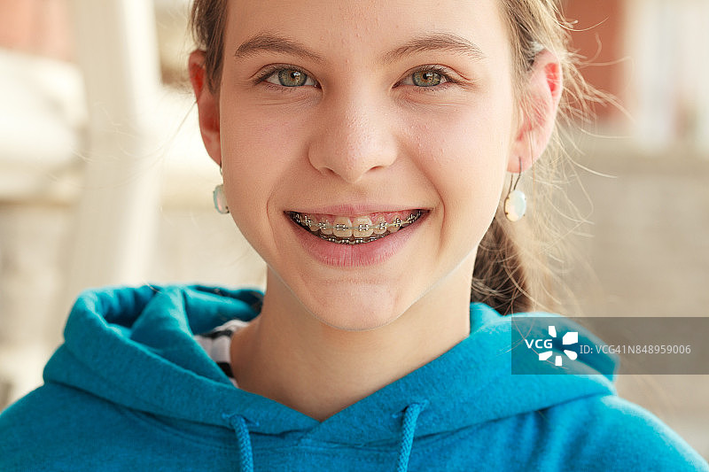 戴牙套女孩的特写肖像图片素材