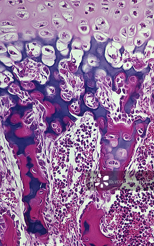 骨细胞——成骨细胞和骨细胞，长骨骺板（生长板）中发育中的骨骼，50倍图片素材