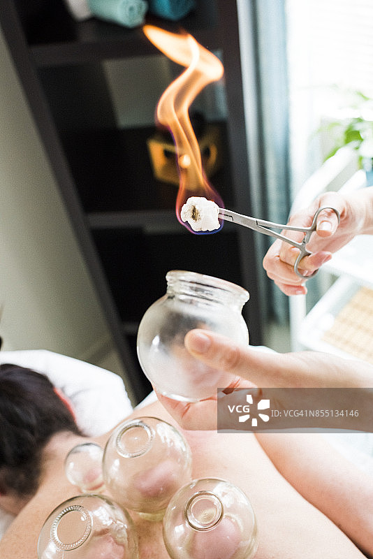 女人俯卧接受拔罐针灸特写图片素材