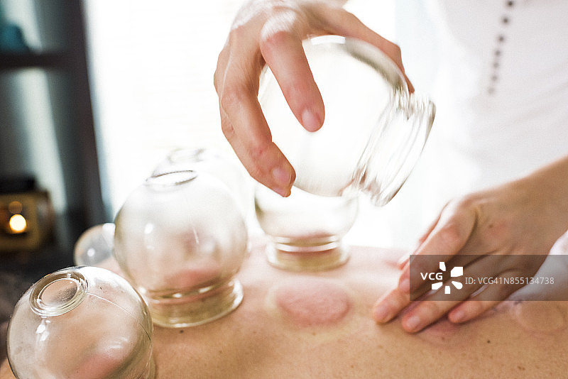 女子背部移除中医拔罐器具图片素材