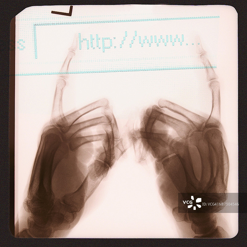 指向网站URL的手部X光片图片素材