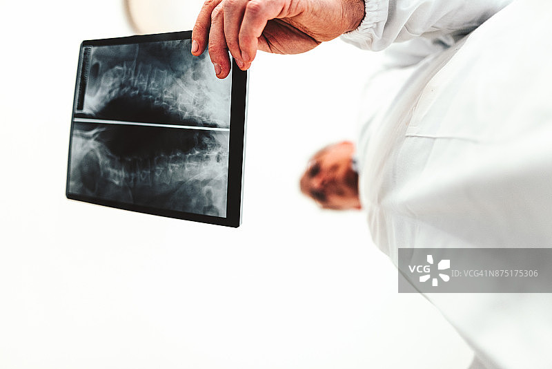 医生在家看X光片图片素材