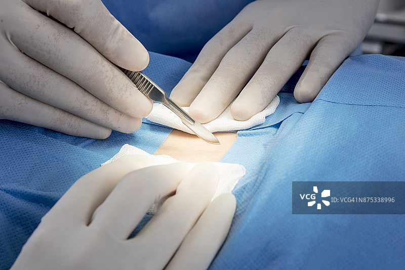 医生在医院手术室做手术图片素材