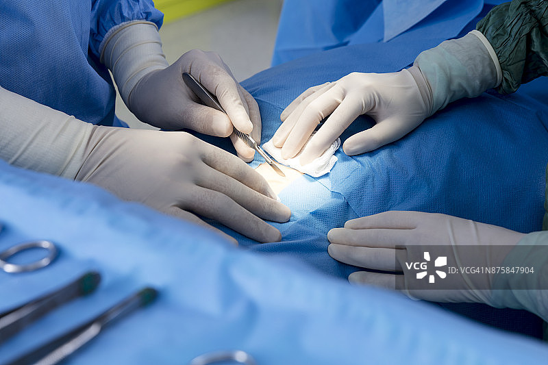 医生在医院手术室做手术图片素材