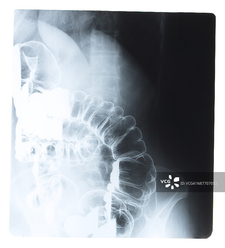 显示物体、脊柱和骨盆的X光片图片素材