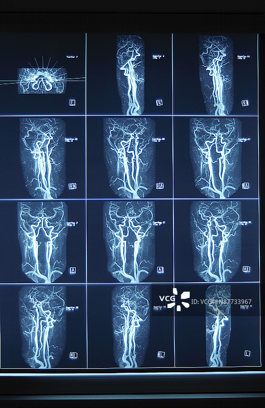 心血管扫描图片素材