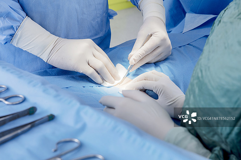 医生在医院手术室做手术图片素材