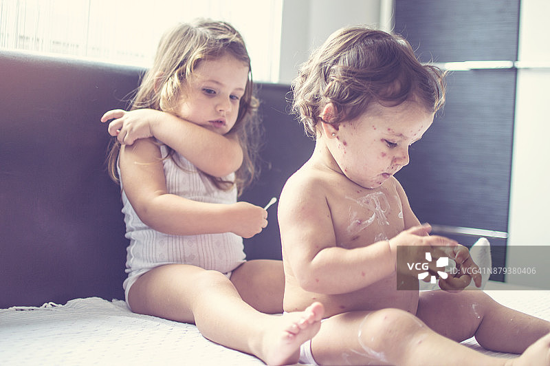患有水痘，皮疹上涂有抗菌软膏的小女孩图片素材