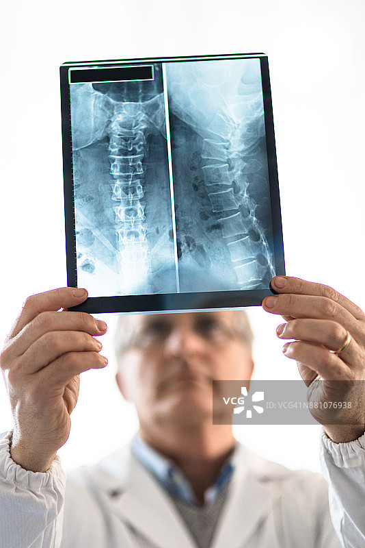 医生在家看X光片图片素材