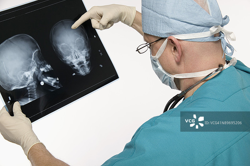 外科医生查看X光片图片素材