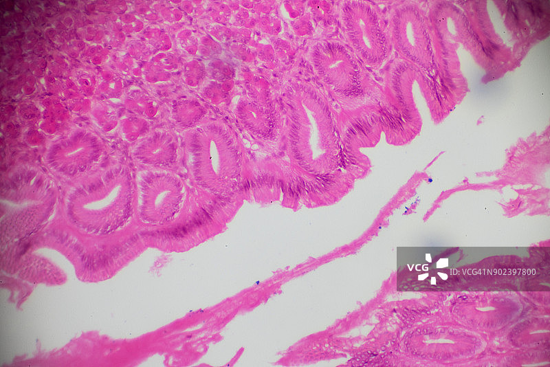 胃底活检显微镜图片素材