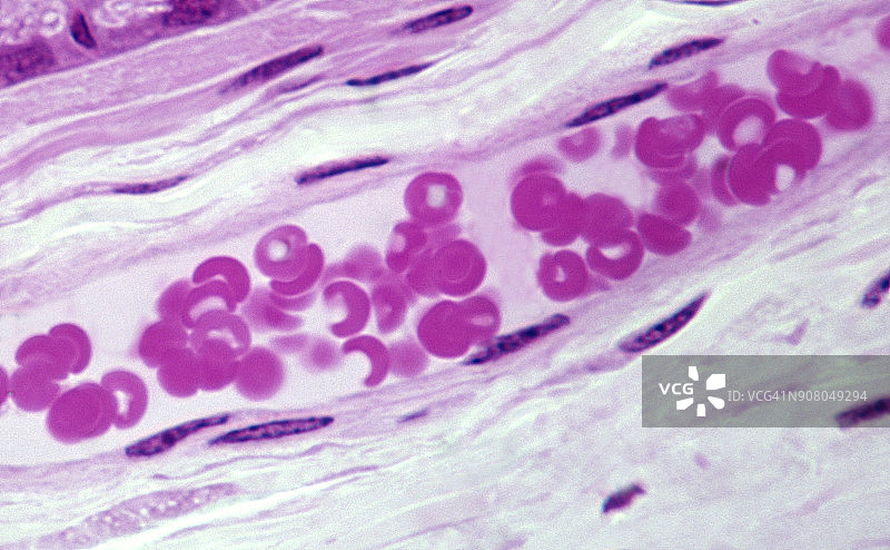 小静脉内大量红细胞纵切面（250倍）图片素材