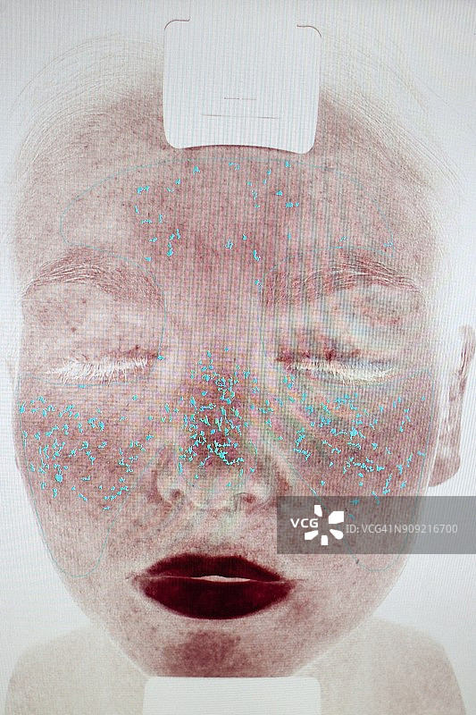 皮肤诊所中的年轻女子面部图片素材