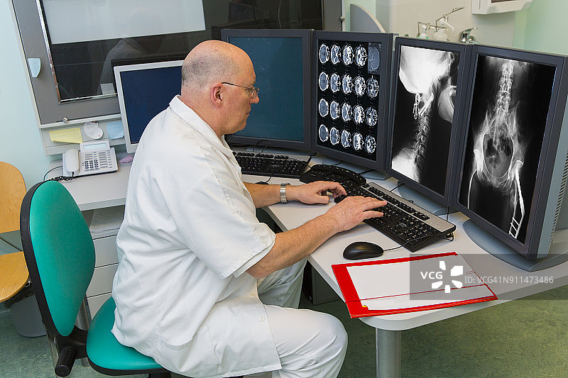 肿瘤研究所的资深放射科医生检查MRI扫描图片素材