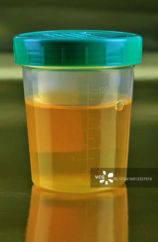 密封容器中的人类尿液样本图片素材