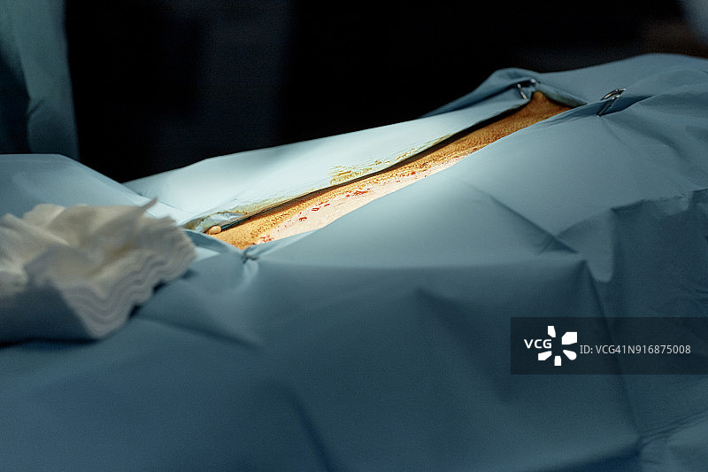 手术室里盖着手术单的狗狗图片素材