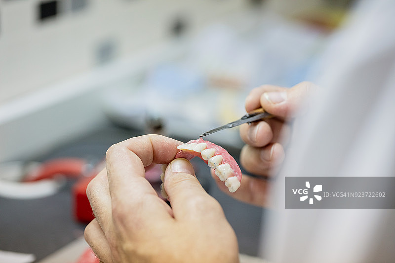 制作牙科假体图片素材