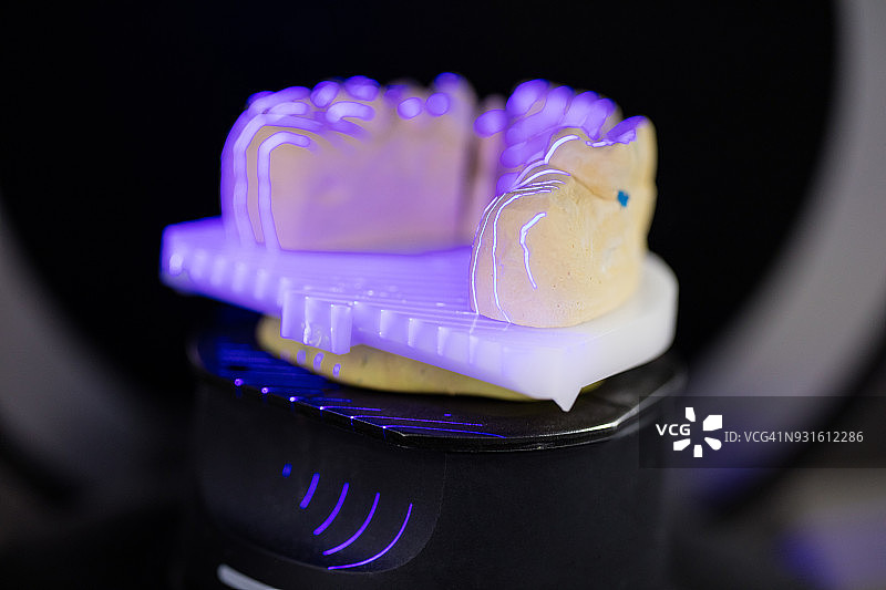 扫描假牙图片素材