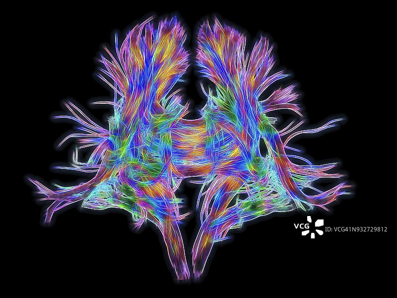 人脑的白质纤维DSI扫描图片素材