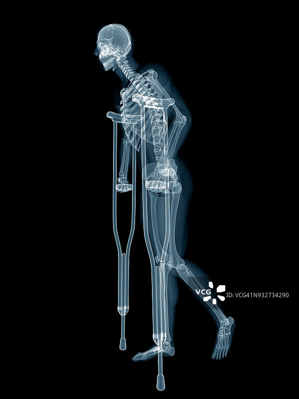 拄着拐杖的人的骨骼系统插图图片素材