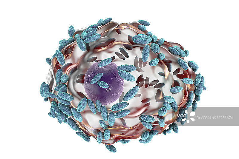 细菌性阴道病，图示图片素材