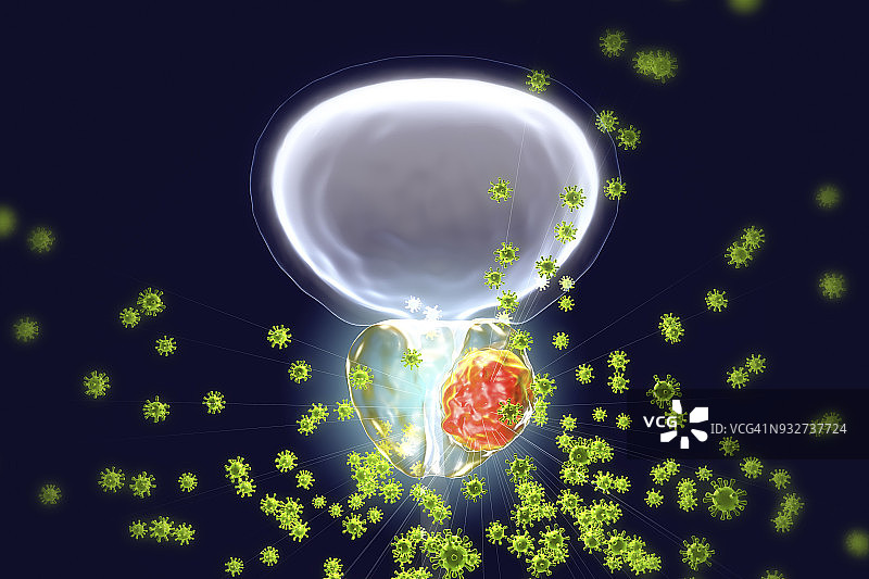前列腺癌的病毒病因概念图图片素材