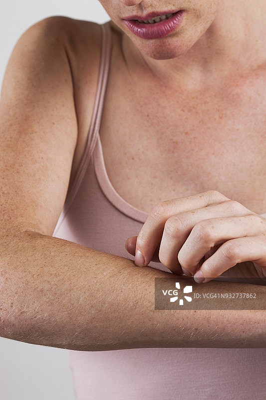 女人挠胳膊图片素材