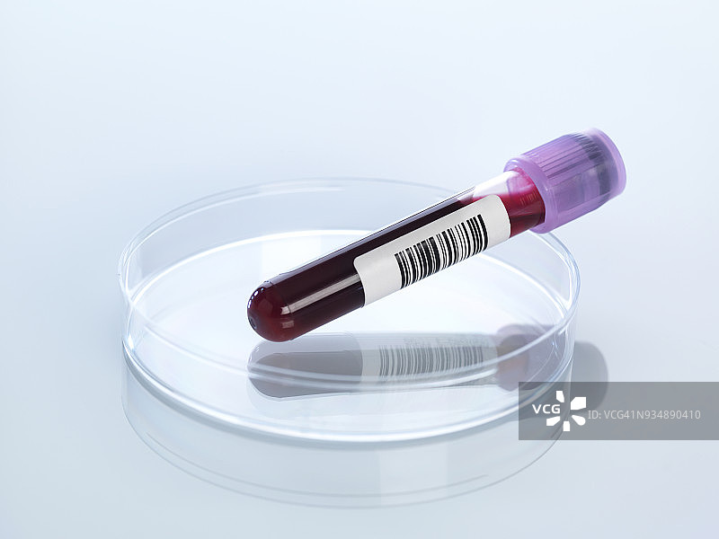 培养皿中的血液样本图片素材