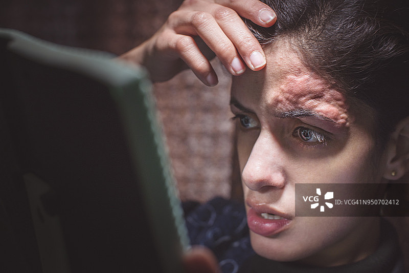 额头因穿线引起的皮肤炎症图片素材