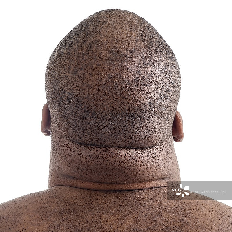 超重男人的脖子特写图片素材