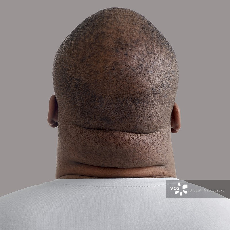 超重男人的脖子特写图片素材