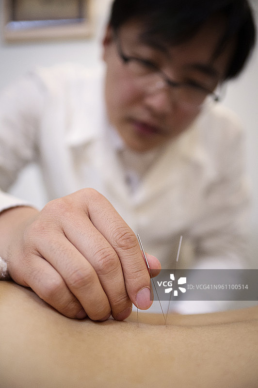针灸师在背部施针图片素材