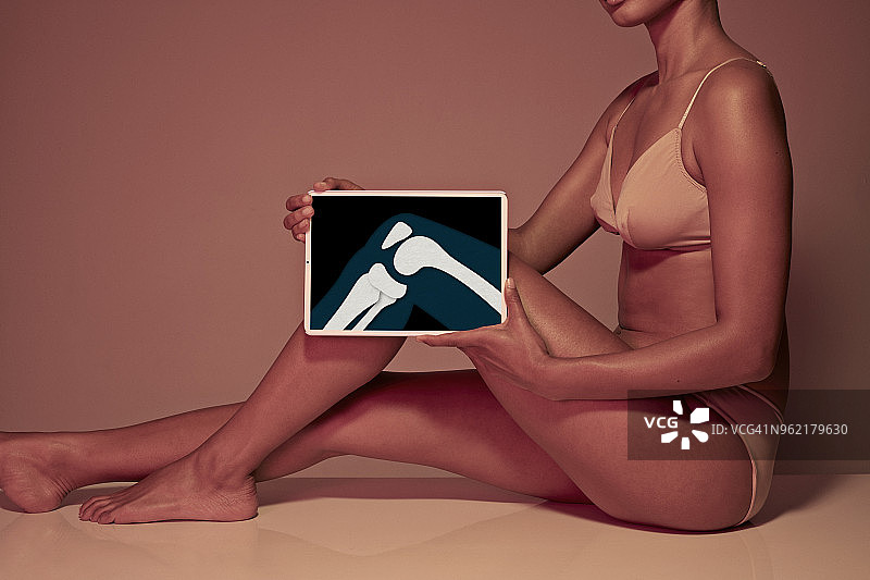 年轻女人手持平板电脑展示膝盖骨图片素材