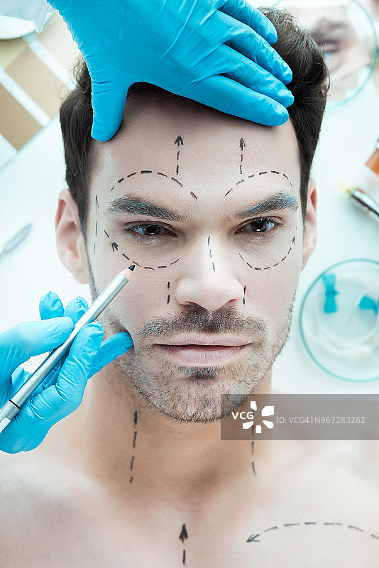 整形外科图片素材