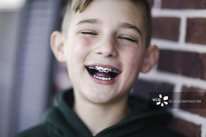 戴着牙套欢笑的男孩图片素材