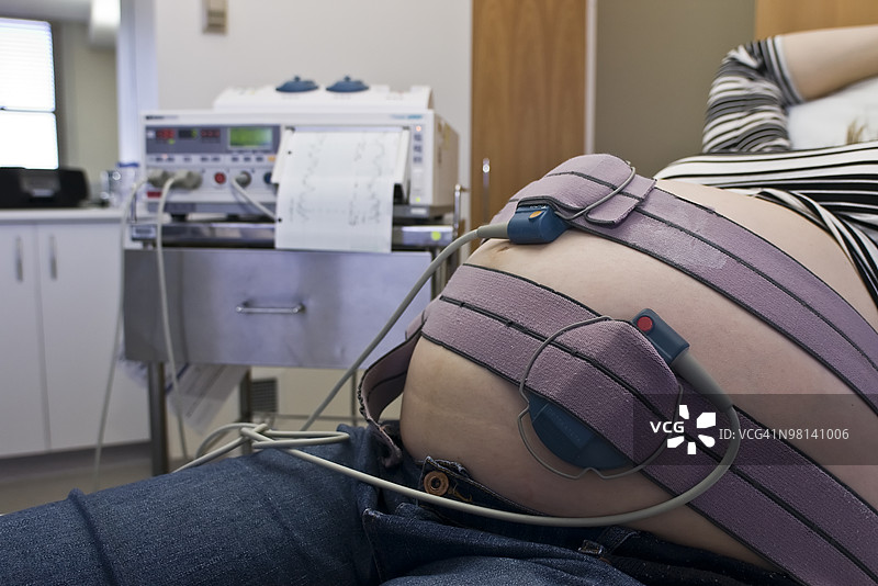 胎儿监护仪记录子宫内未出生婴儿的健康状况图片素材