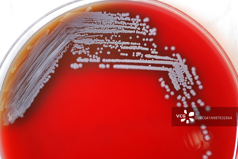 类鼻疽伯克霍尔德菌图片素材