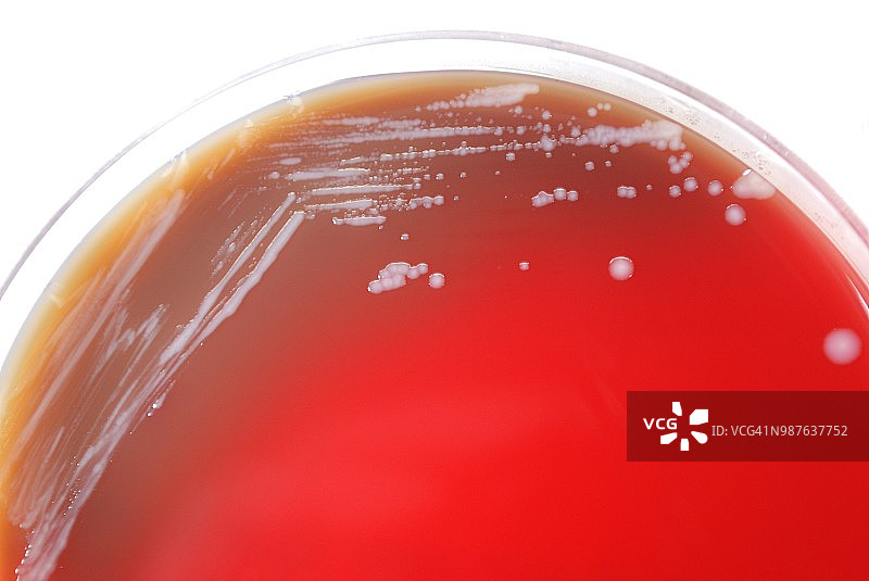 培养皿中的马氏伯克霍尔德菌图片素材