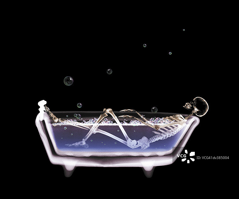 浴缸里的骨骼X光片图片素材