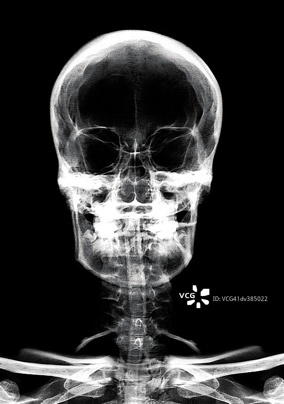 头骨正面图图片素材