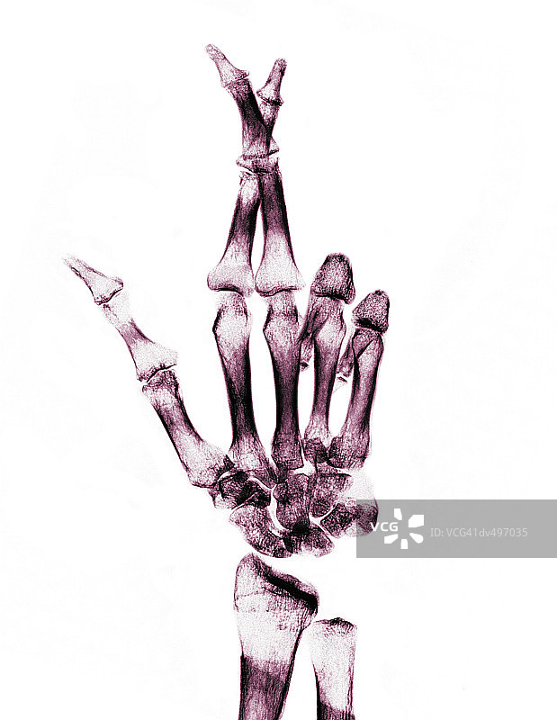 交叉手指图片素材