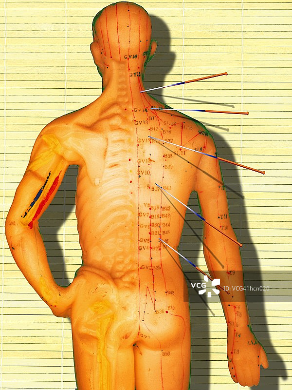 针灸图图片素材