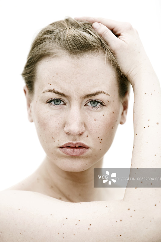 脸上和手上有痣的年轻女人肖像图片素材
