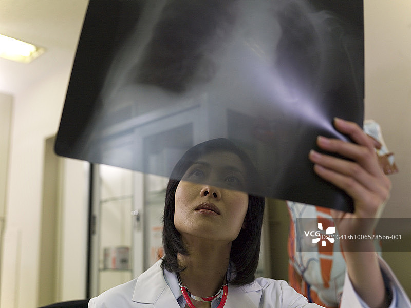女医生在医院检查X光片图片素材