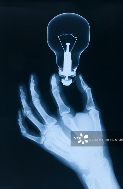 人手持灯泡X光片特写图片素材
