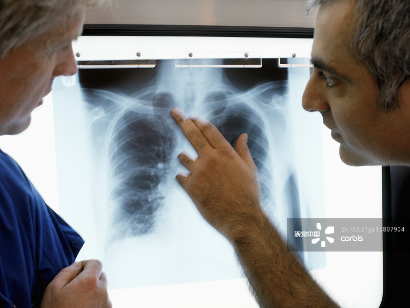 两位医生正在查看X光片图片素材