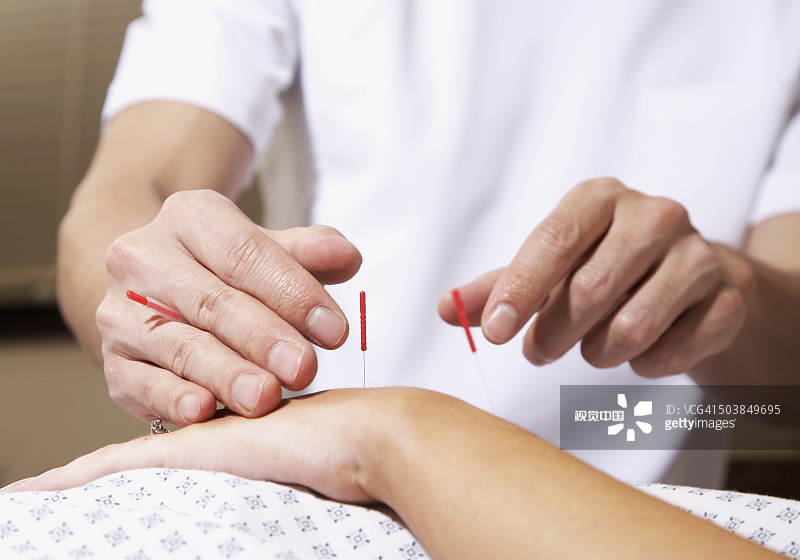 针灸师为患者进行治疗图片素材